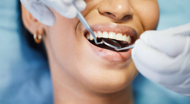 Best Same-Day Emergency Dental Services in Iowa Park, TX